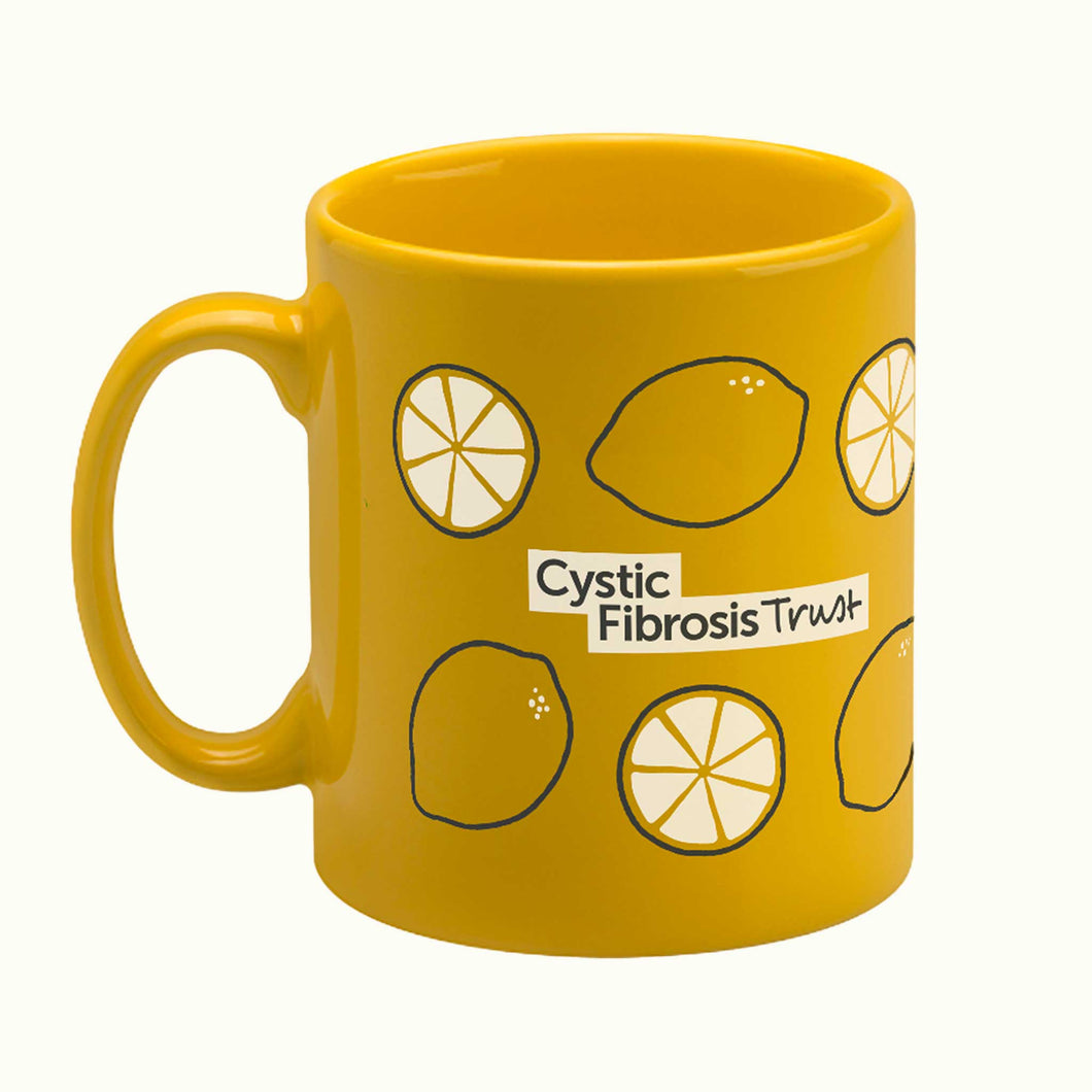 Celebratory Yellow Mug